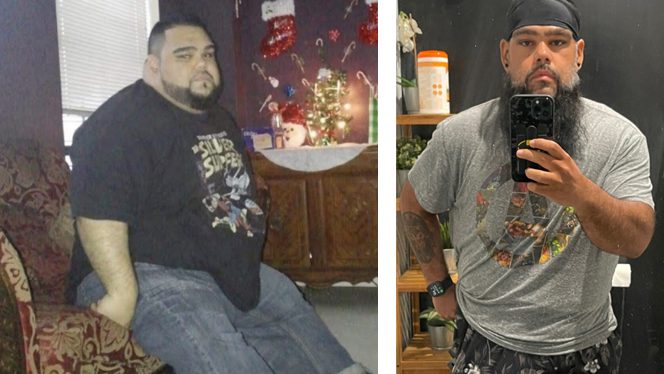 I Lost 400 Pounds, Reversed Kidney Disease on a Whole-Food Vegan Diet